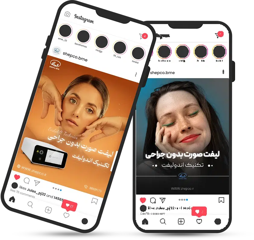 خدمات اینستاگرام تجهیزات پزشکی